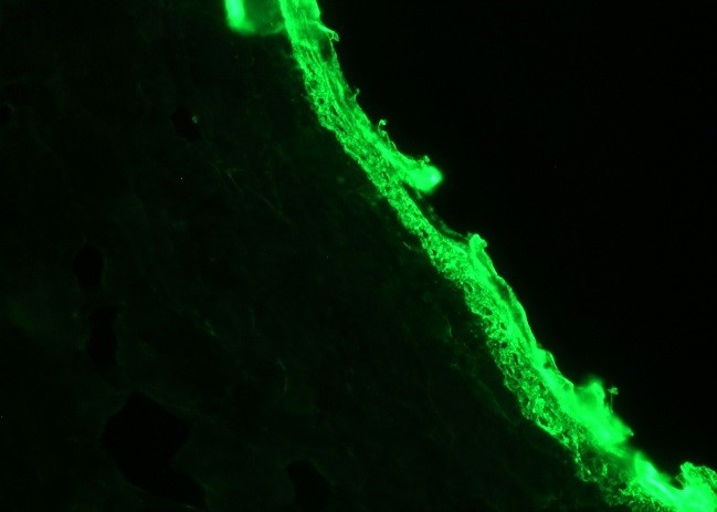 Figure 1. Indirect immunofluorescence staining of frozen section of dog skin with MUB0312P (RCK103) showing positive staining in basal cells of epidermis. Dilution 1:100.